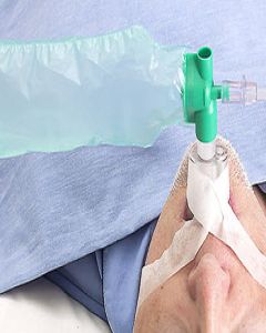 Oxygen Recovery T-Piece W/ Reservoir Bag - Box of 100